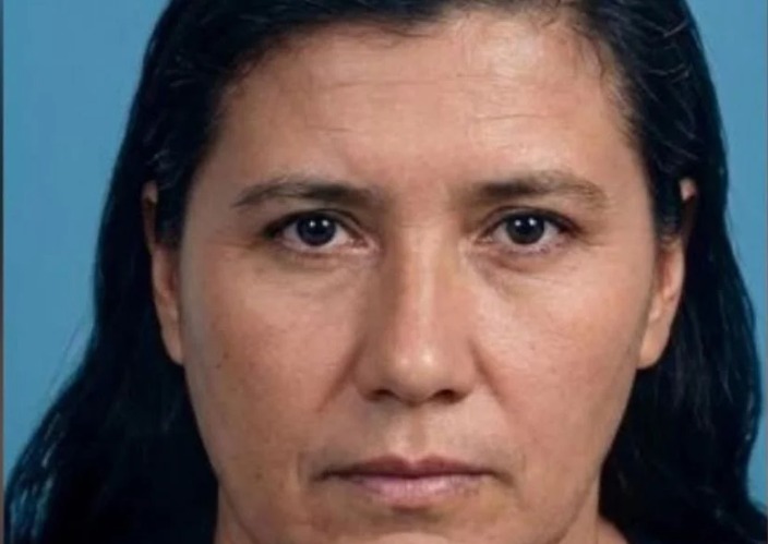 Ama de casa murió tras atragantarse mientras comía bollo de yuca en su casa en Manzanares