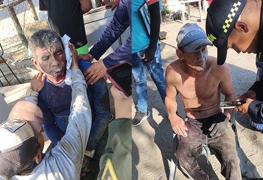 Dos obreros resultaron heridos, tras colapsar parte de una estructura en construcción en el Rodadero