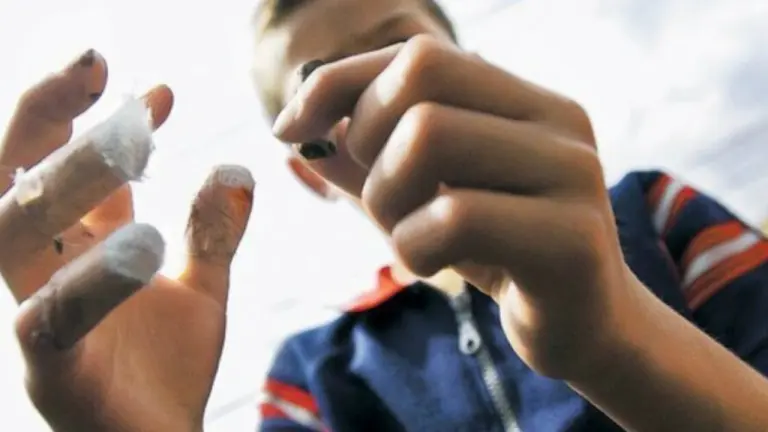 INS reporta 172 lesionados por pólvora en la noche de velitas en todo el país