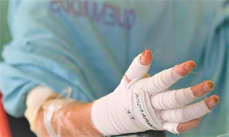 Padres serían responsables si menores resultan quemados con pólvora